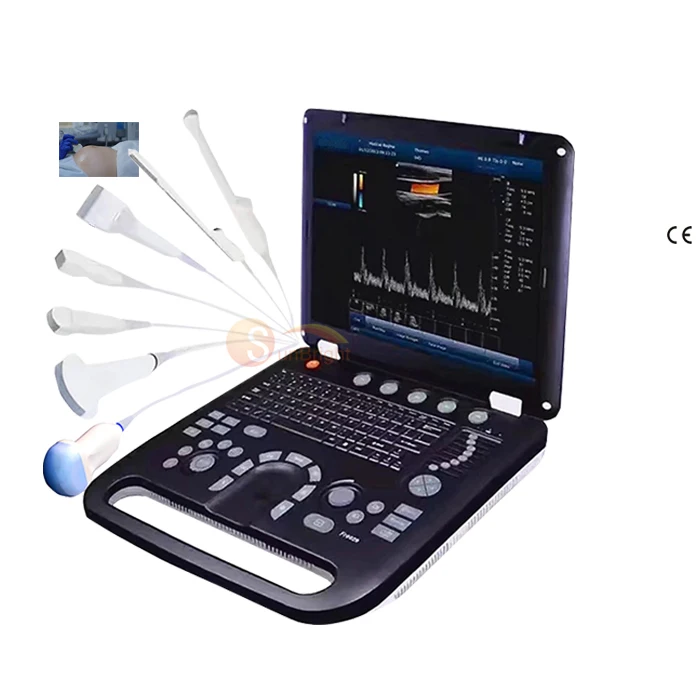 Hospital Portable Color Doppler Ecograph Best Price 3D 4D Veterinary Portable Color Doppler Ultrasound