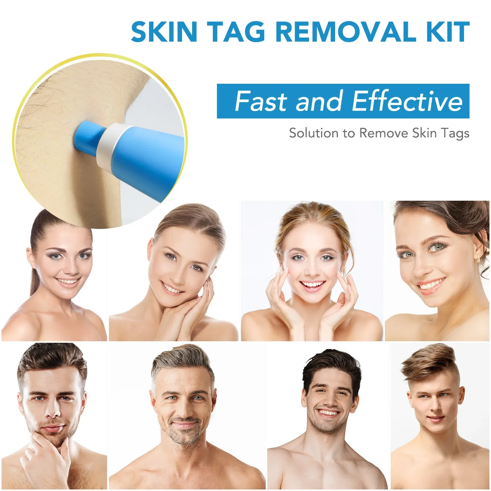 2-In-1 Auto Skin Tag Remover Kit Portable Micro Skin Tag Removal Device Adult Mole Stain Wart Corn Remover Face Care Beauty Tool