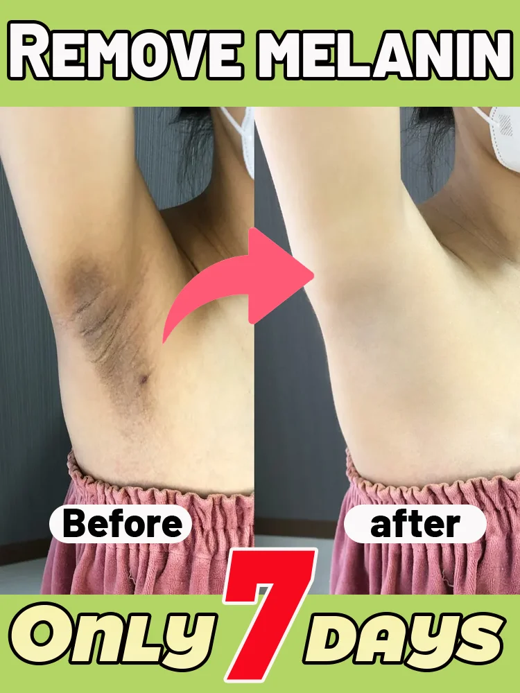 ᴺᵉʷ ᵗʳᵉⁿᵈ ᵒᶠ ᵖʳⁱᵛᵃᵗᵉ ʷʰⁱᵗᵉⁿⁱⁿᵍSay goodbye to dullness and restore radiance