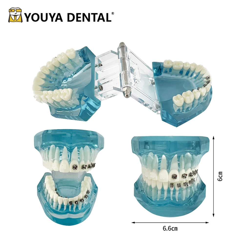 

Dental Model Teeth Teaching Model With Self Ligating/ Metal/ Lingual/ Ceramic Orthodontic Brackets Teeth Model For Studying Demo