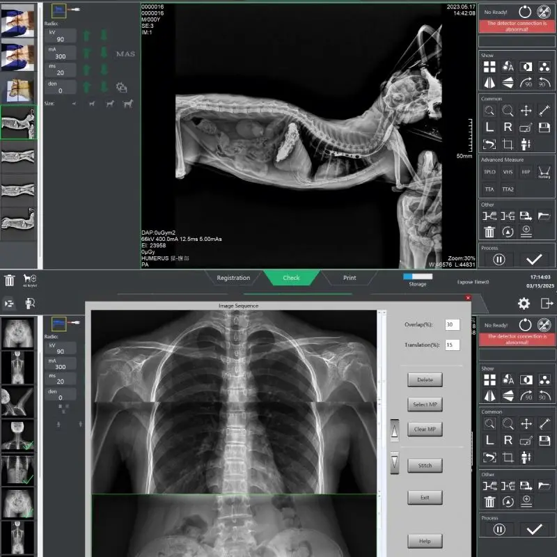 Low Dose 17x17 Inch CSI Wireless DR X-ray Flat Panel Detector System for Hospital Medical Digital Radiography