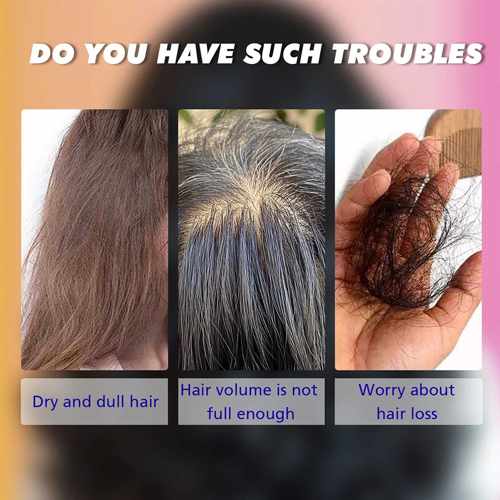 빠른 모발 성장 탈모 방지 오일, 생강 에센셜 하이 헤어 라인 헤드 헤어 세럼, 무모 대머리 증가 에센스 크림, 60ml