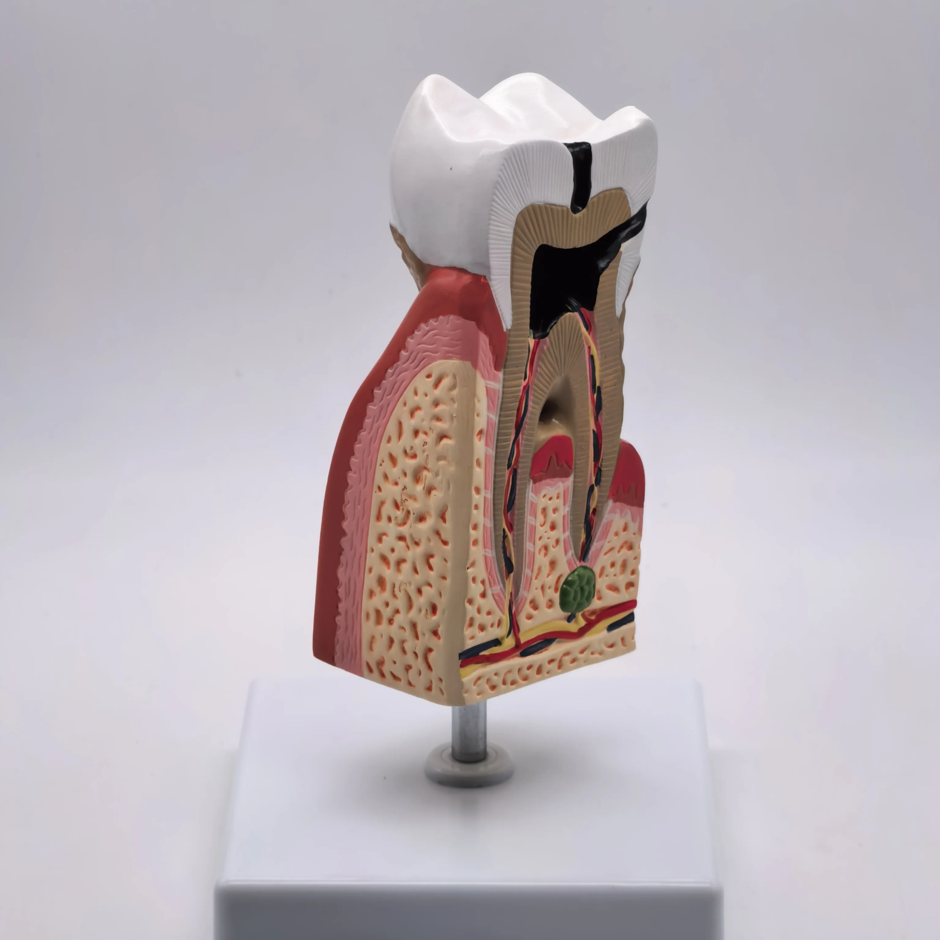 Anatomia médica do modelo anatômico dos dentes malezas humanos do PVC para a educação do paciente