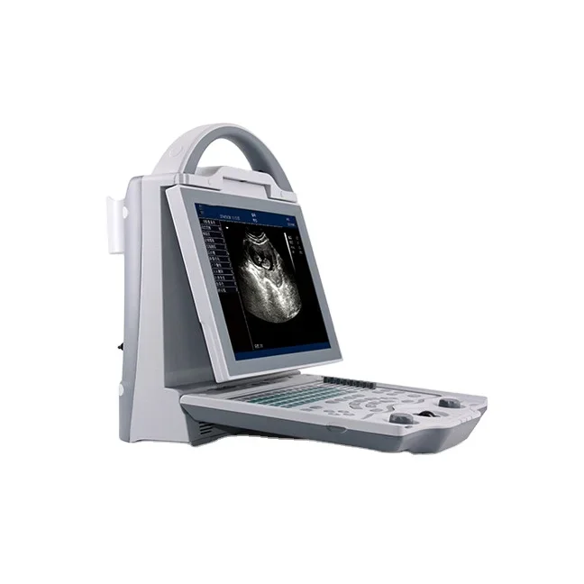 Hospital Full Digital Medical Portable Ophthalmic AB Ultrasound Scanner Ultrasound Machine