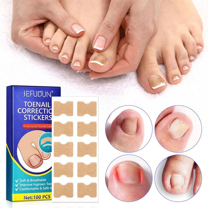 100pcs Nail Correction Patch Embedded in Toenail Correction Patches Repair Toes Orthodontic Paronychia Recover Pedicure Tool