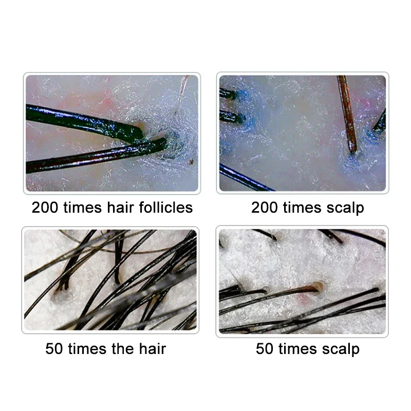 

10 Inch LCD Scalp Detector Digital Hair Skin Analyzer Microscope for Hair Follicle Testing and Skin Analysis Magnifier 50/200X
