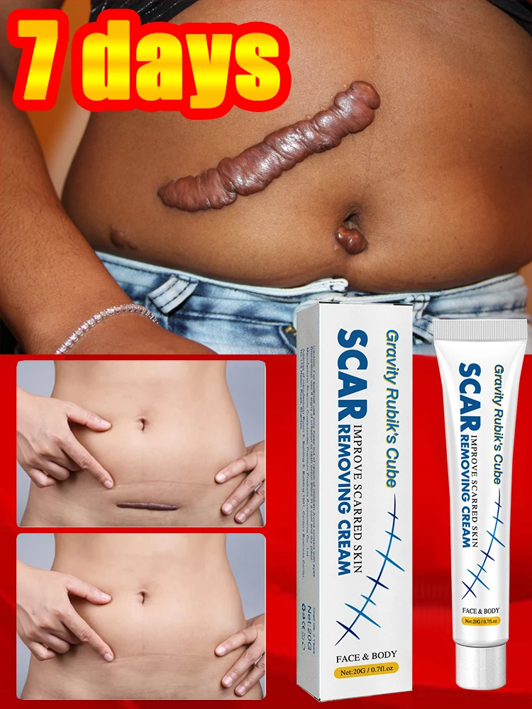 

Treat and repair burn scars, reduce old keloids, and promote wound healing