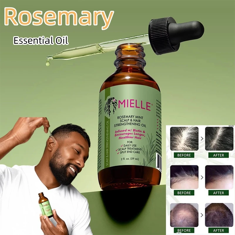 Mielle Rosemary Hair Growth Essential Oil Mint Nourishing Treatment for Split Ends and Dry Organics Hair Loss Treatment Healthy