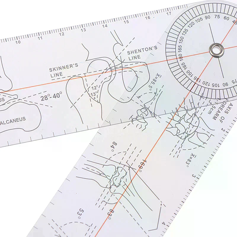 Alat Ukur Sudut Multi-Ruler Goniometer Medis untuk Ortopedi Sendi