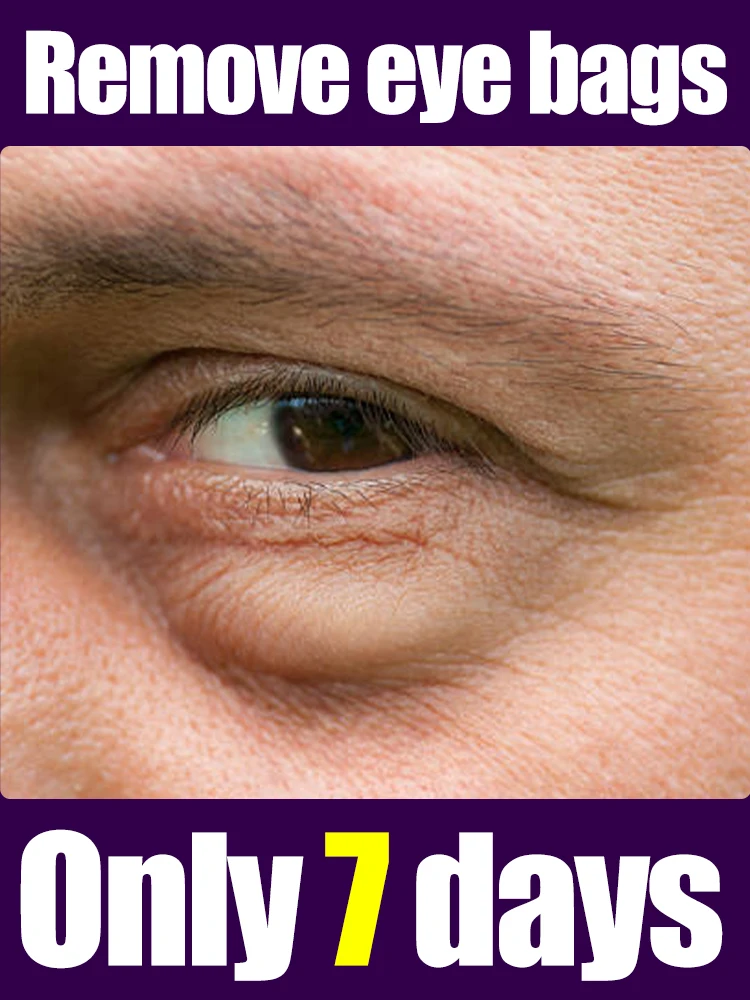 2025 Nieuwe upgrade oogzorgtools, massage lost verschillende problemen op, gratis verzending