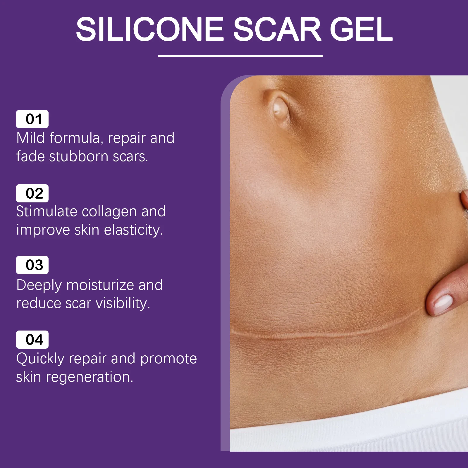 Scar Gel Scar Lightening Skin Rejuvenation Surgery Scar Healing Wound Recovery Cream Remove Acne Spots Treat Stretch Marks Burns