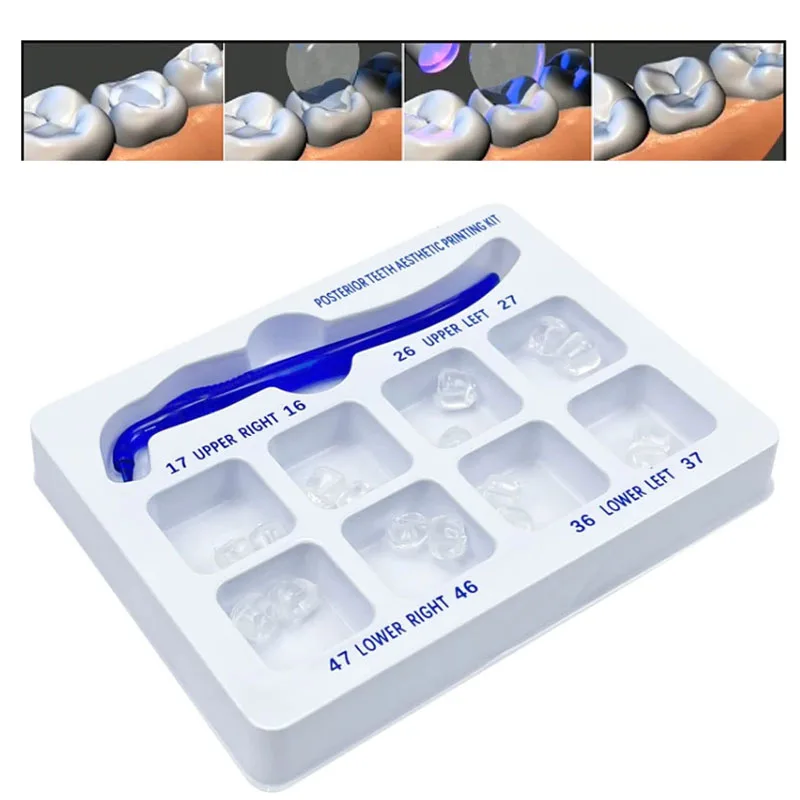 1Set Dental Resin Veneer Posterior Teeth Aesthetic Printing kit Dental Light-curing Resin Filling Molding Remodeling Molds