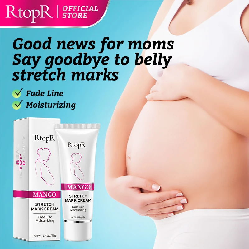 Mango Remove Pregnancy Scars Acne Cream Stretch Marks Treatment Maternity Repair Anti-Aging Anti-Winkles Firming Body Creams