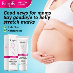 Mango Remove Pregnancy Scars Acne Cream Stretch Marks Treatment Maternity Repair Anti-Aging Anti-Winkles Firming Body Creams