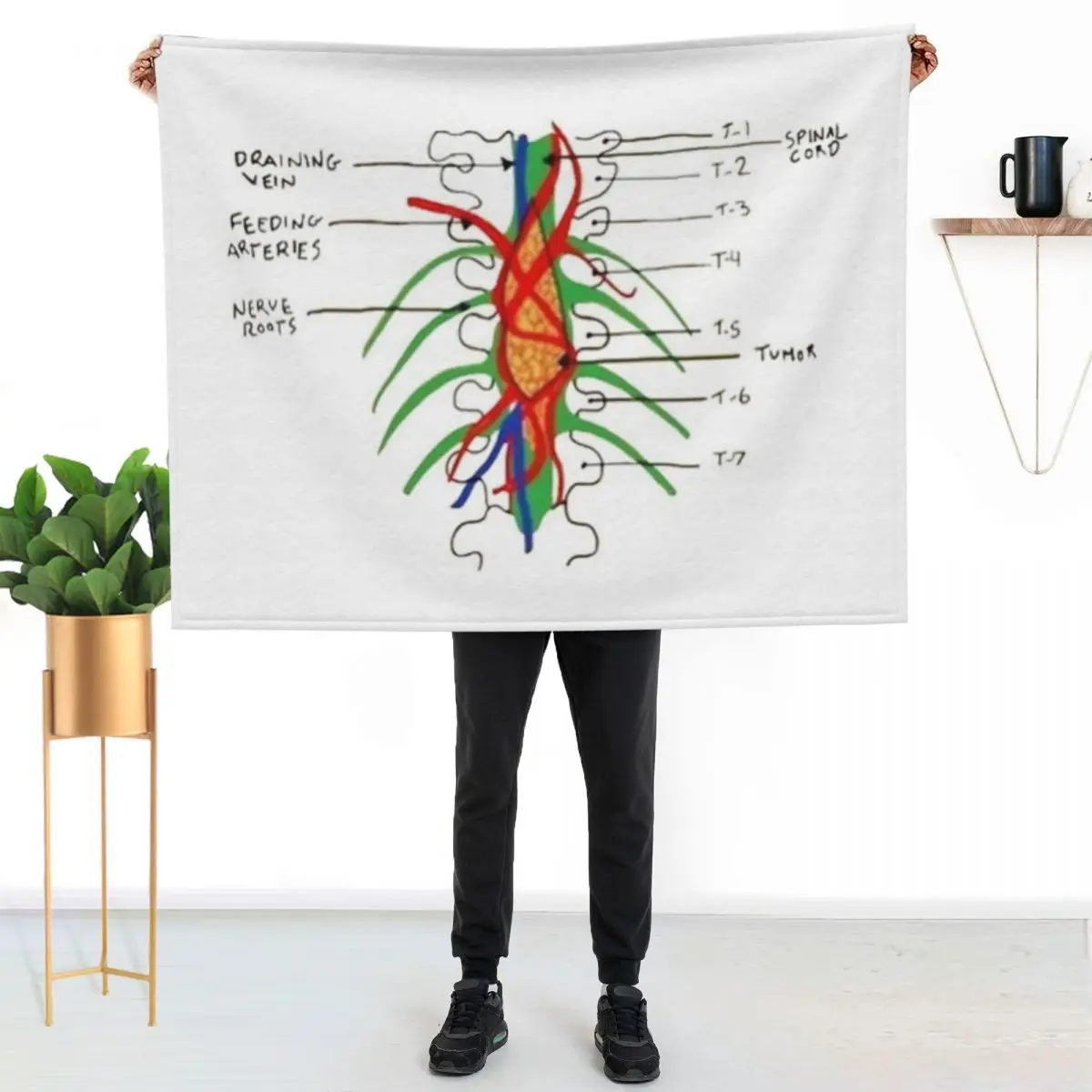 Greys - Spinal tumour Throw Blanket Hairy Stuffeds Thermals For Travel Sleeping Bag Multi-Purpose Decorative Sofas Blankets