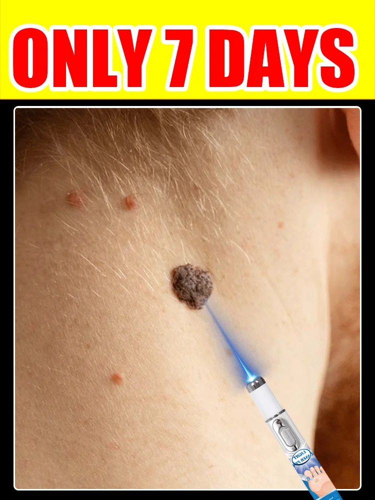 

2025 hot sale Laser Therapy wart Repair Pen