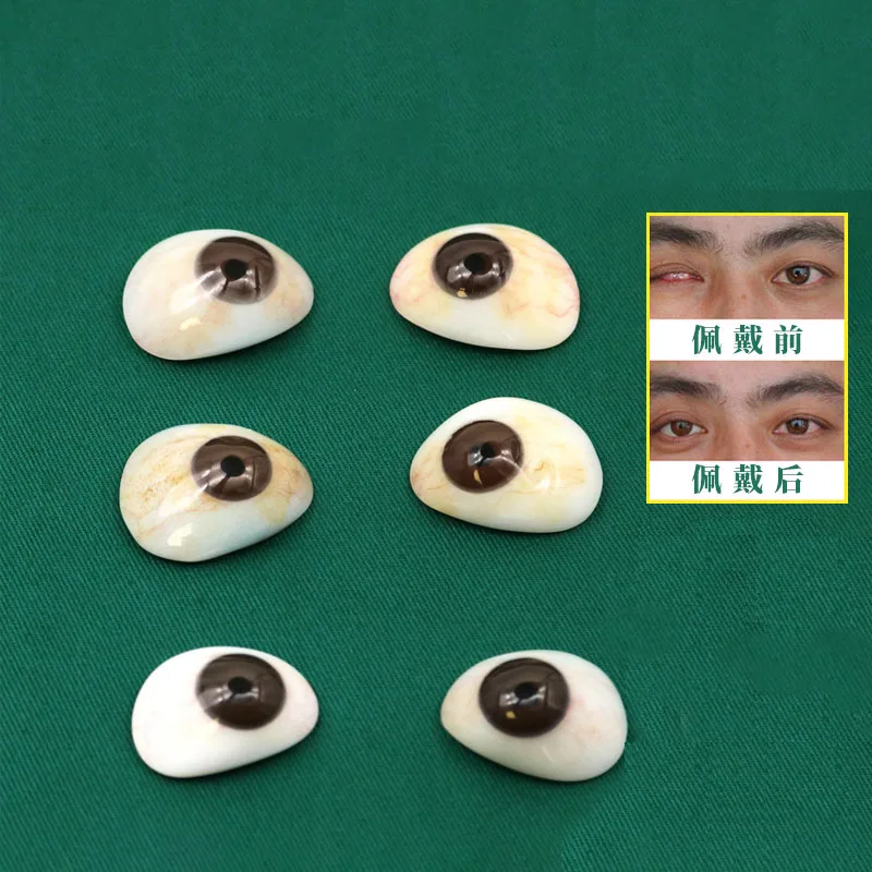 Molecular resin artificial eye patch for removal of atrophic eyeballs in humans wearing ultra-thin wax images to display simulat