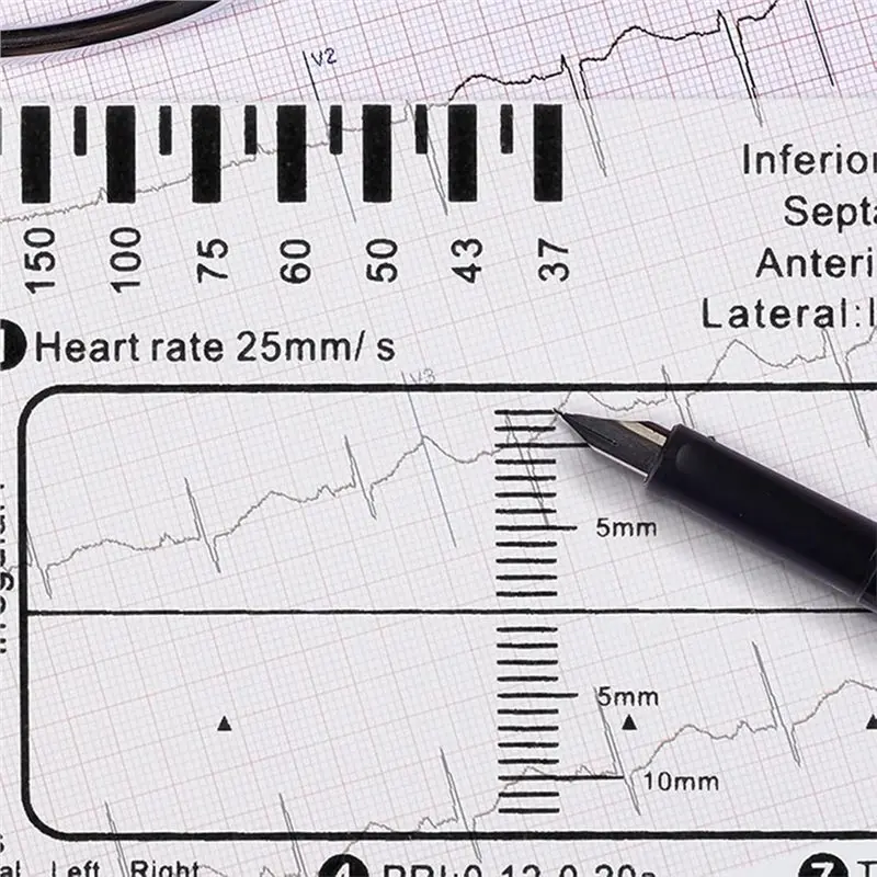 Beauty Transparent EKG Calipers, 10Pcs ECG 7 Step Ruler For Accurate Heart Rate Measurement