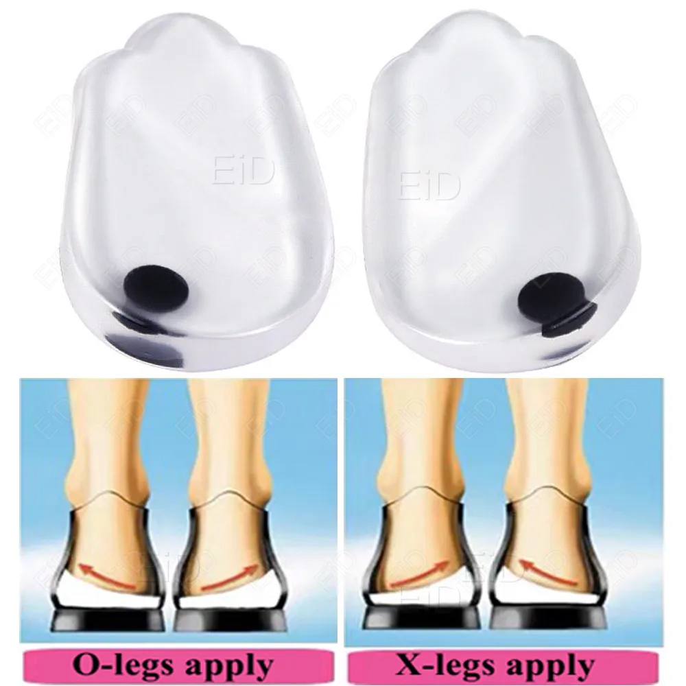 1 Pair Magnets Silicon Orthopedic Insoles Foot Care Tool For Men Women Health Care O/X Type Legs Knee Varus Correction Heel Pads image 4