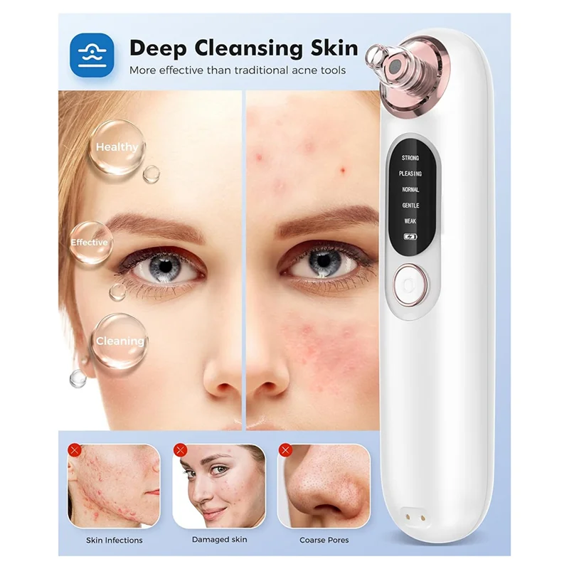 Removedor de espinillas B51C para pieles sensibles, limpiador de poros faciales con 4 cabezales extraíbles, Kit de acero inoxidable