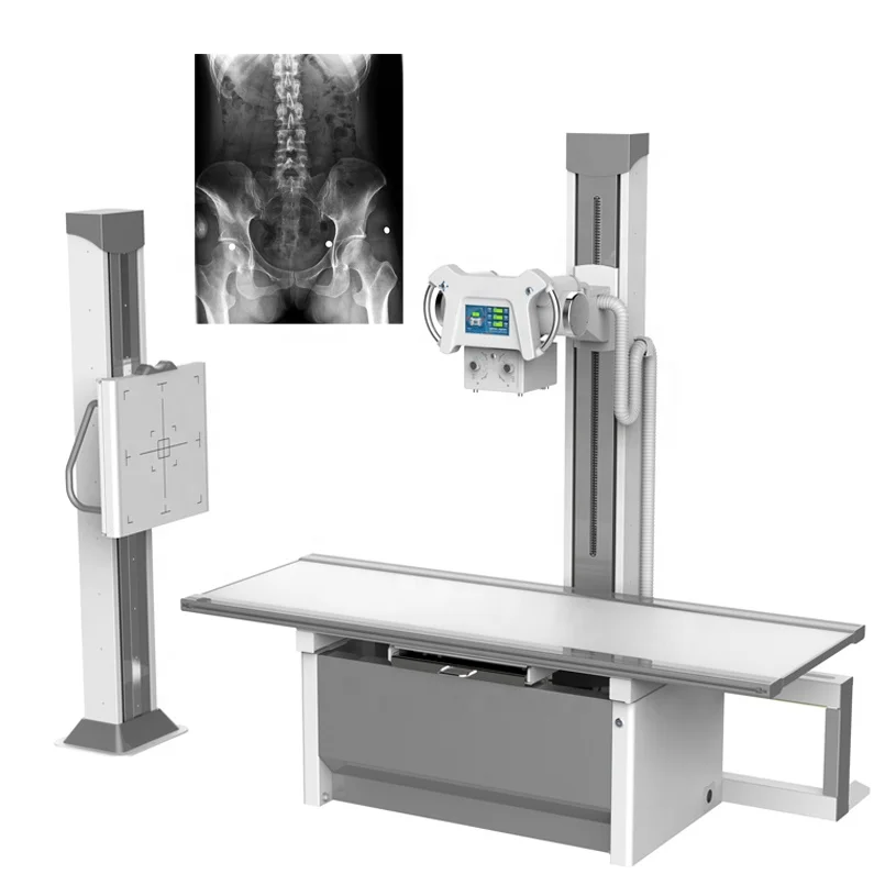 200-630mA High Frequency Radiography x ray digital machine price