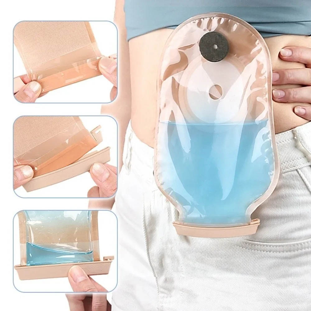 5Pcs Durable Plstic Ostomy Bag Clip Reusable Flexible Drainable Pouch Clamp Ostomy Tail Closure Ostomy Care
