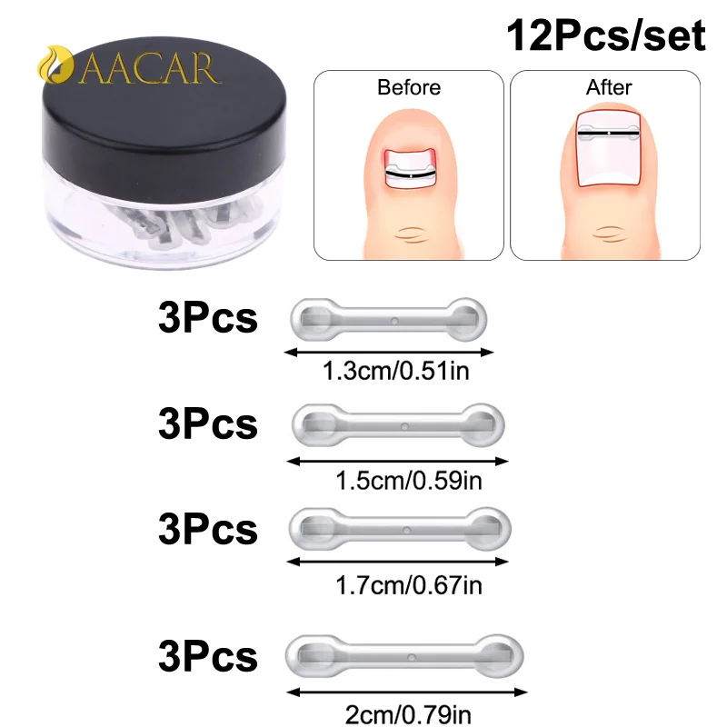 12개입 내성발톱 치료 키트, 4가지 다양한 크기, 티타늄 합금 내성발톱 교정 도구, 곡선형 발톱 교정기