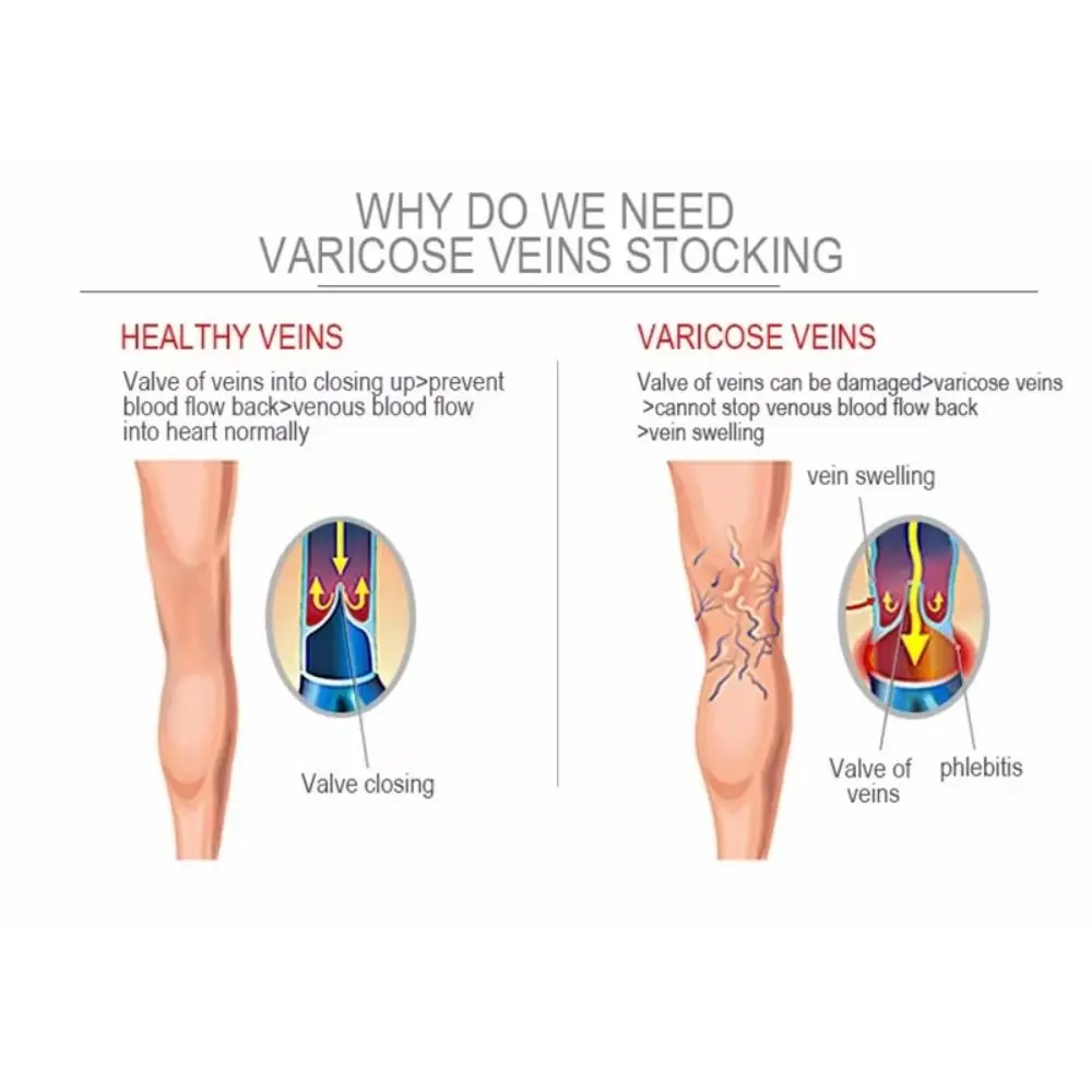 

Fashion Knee High Compression Socks Stretchy Solid Color Pressure Socks Long Socks Women Men