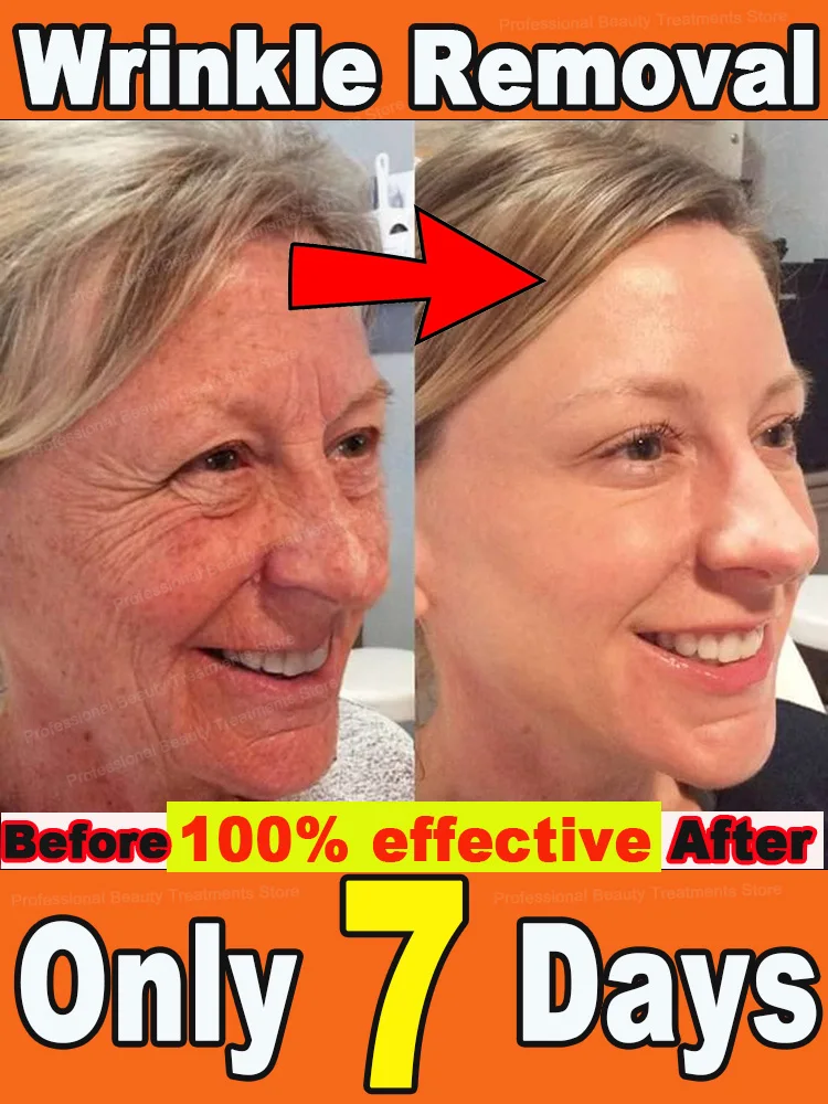 Wrinkles disappear Become beautiful now