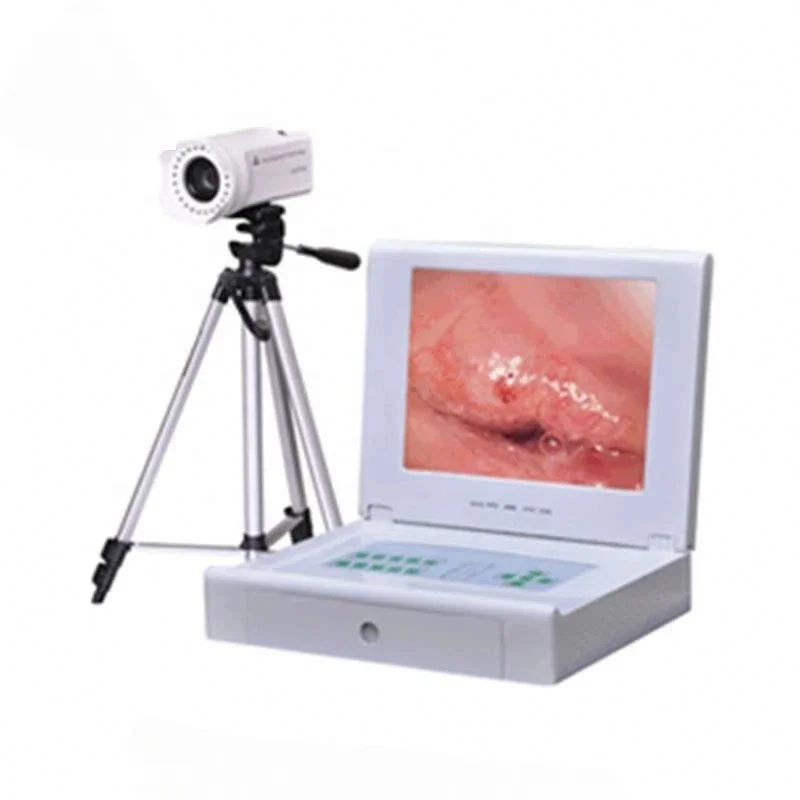 colposcopy for gynecology well infrared colposcopy equipment Wholesale price medical equipment portable digital electronic