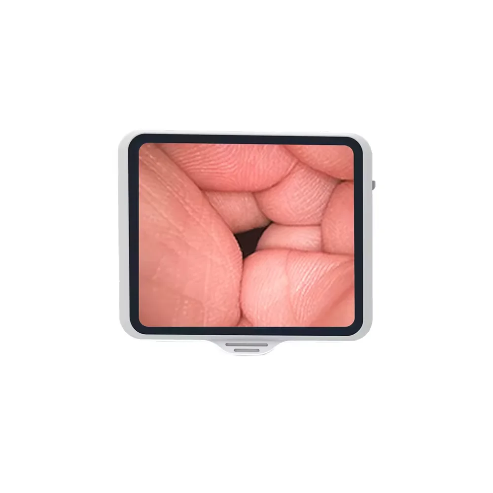 Endoscópio médico flexível portátil Full HD 3,5 polegadas 1080P para sistema de imagem de endoscopia de laparoscopia