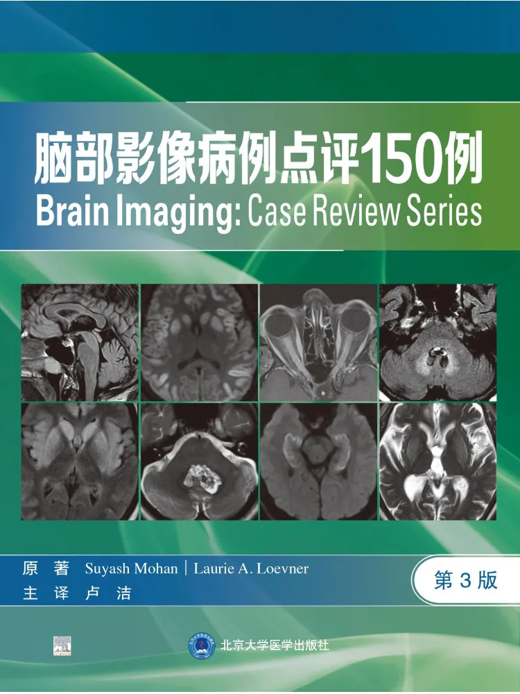 Book-Winshare 150 Case Studies in Brain Imaging 3rd Edition