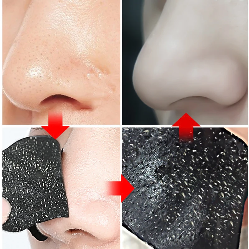 1 PC Nose Strips For Blackheads Acne Removal Instant Pore Unclogging Strips Deep Cleansing Nose Clean Patch Strips Sample Size