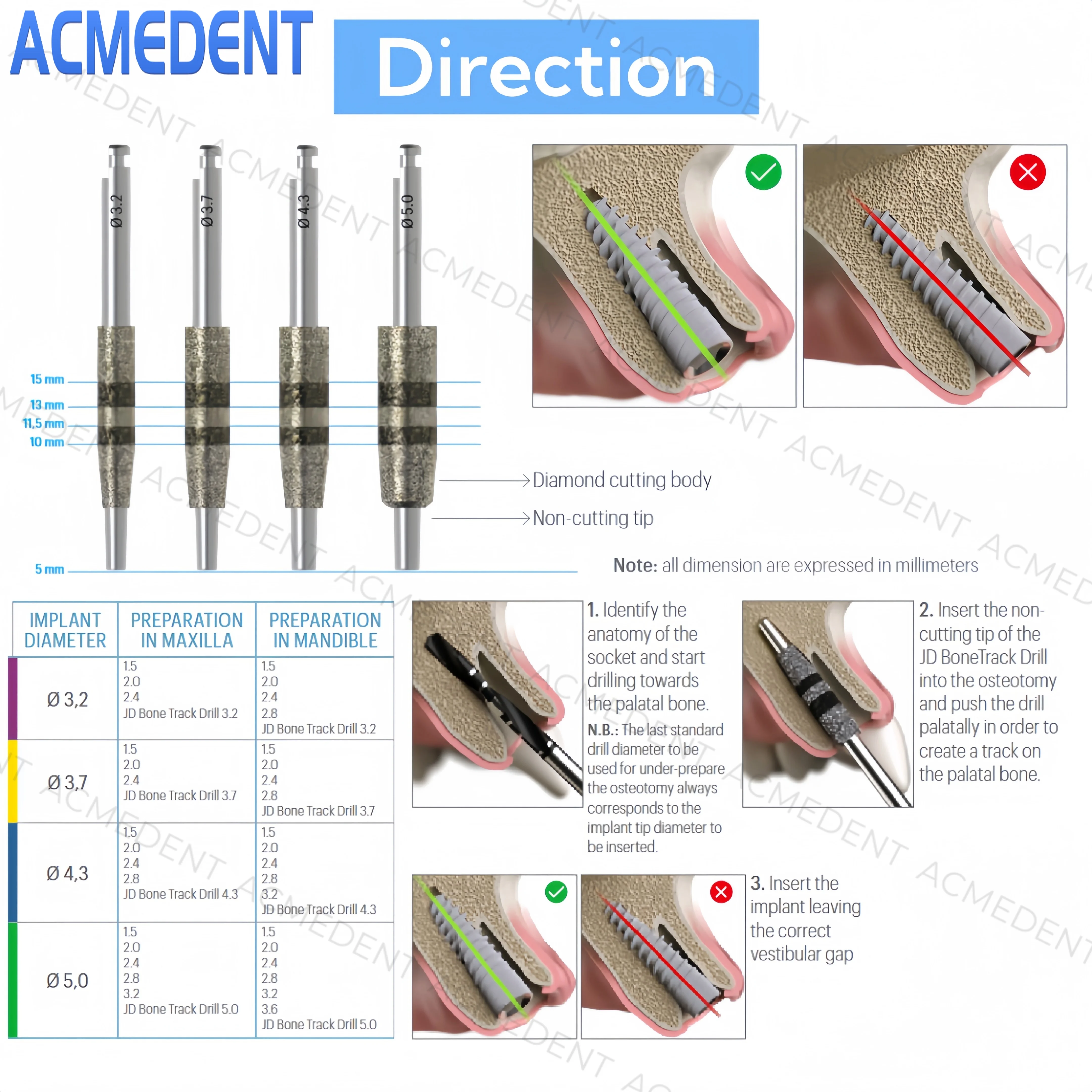 Bone Track Drill Kit Dental Implant Guided Neck Correction Drill Diamond Grinding Jawbone Non-Cutting Tip Diamond Cutting Body - Image 3