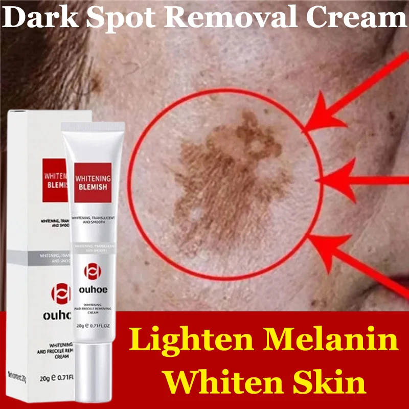 

Niacinamide Melasma Brightening Cream Reduce Melanin Brighten Cream Lighten Dark Skin Chloasma Repair Serum Face Care Products