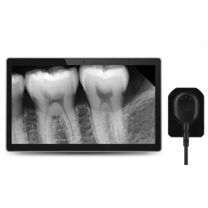 Portable Digital Rvg Dental X-ray Sensor Dental X Ray Dental Xray Sensor For Child