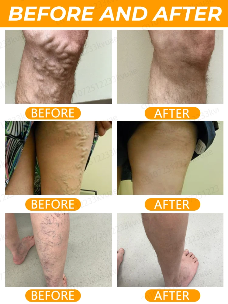 Hᴇᴀʟᴛʜʏ ʟᴇɢs ᴍᴀᴋᴇ ʏᴏᴜ ғᴇᴇʟ ᴄᴏᴍғᴏʀᴛᴀʙʟᴇ ɴᴏ ᴍᴀᴛᴛᴇʀ ʜᴏᴡ ʏᴏᴜ ᴍᴏᴠᴇ