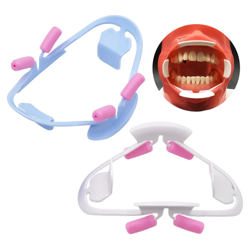 Dental 3D Mouth Opener Oral Cheeck Lip Retractor Dentist Orthodontic O Shape Teeth Mouth Opener Dentistry Oral Treatment Tool