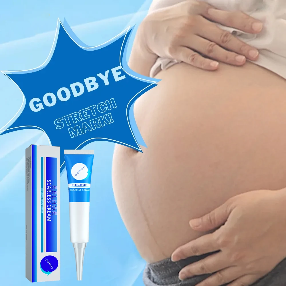

Light Lines Stretch Marks Cream Eliminate Red White Marks Firming Skin Pregnancy Postpartum Care