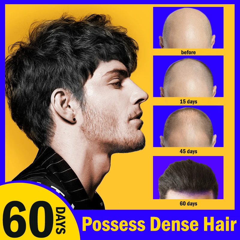 60 Days Hairs Regrowth Anti-Hair Loss Oil Repairs Follicles Thicker Health Strong Thinning Natural Hair Loss Treat