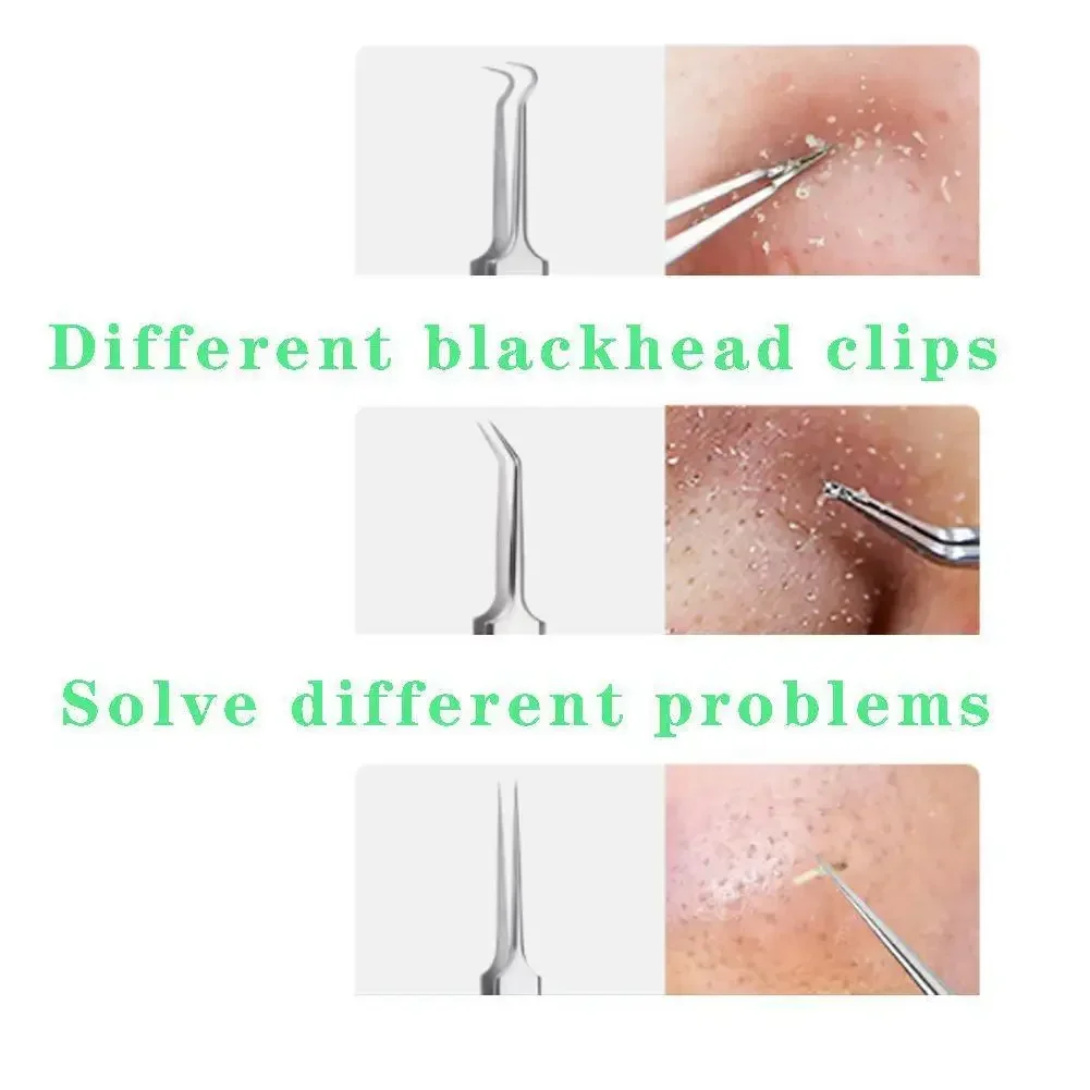 Ultra-fine CELL สิว Blackhead คลิปแหนบ Beauty Salon Scraping & ปิด Artifact เข็มสิวเครื่องมือความงาม-สุขภาพ