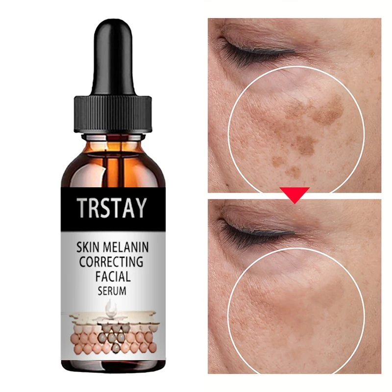 

Nicotinamide Serum Facial Whitening Dark Spot Remover Acne Scar Bright Skin Improve Roughness rejuvenation facial