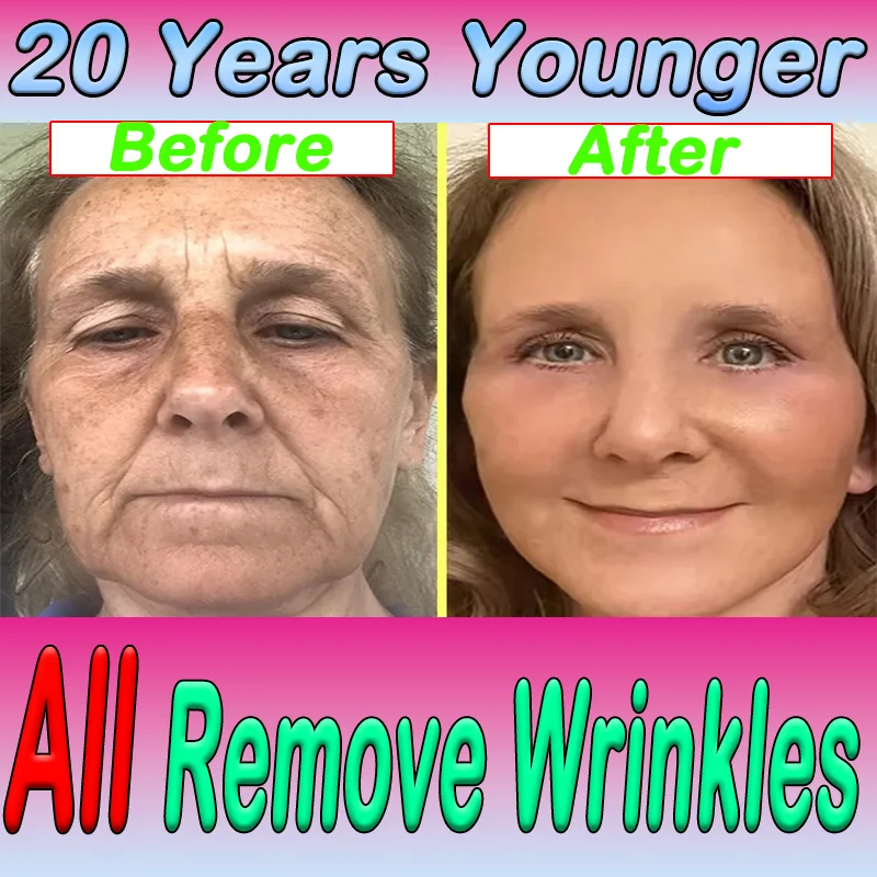 

Face Cream Anti-Aging Face Lift Remove Eyes Bag Wrinkles Skin Product Anti-wrinkle Oxys Cream WrinkleRemove All Wrinkles