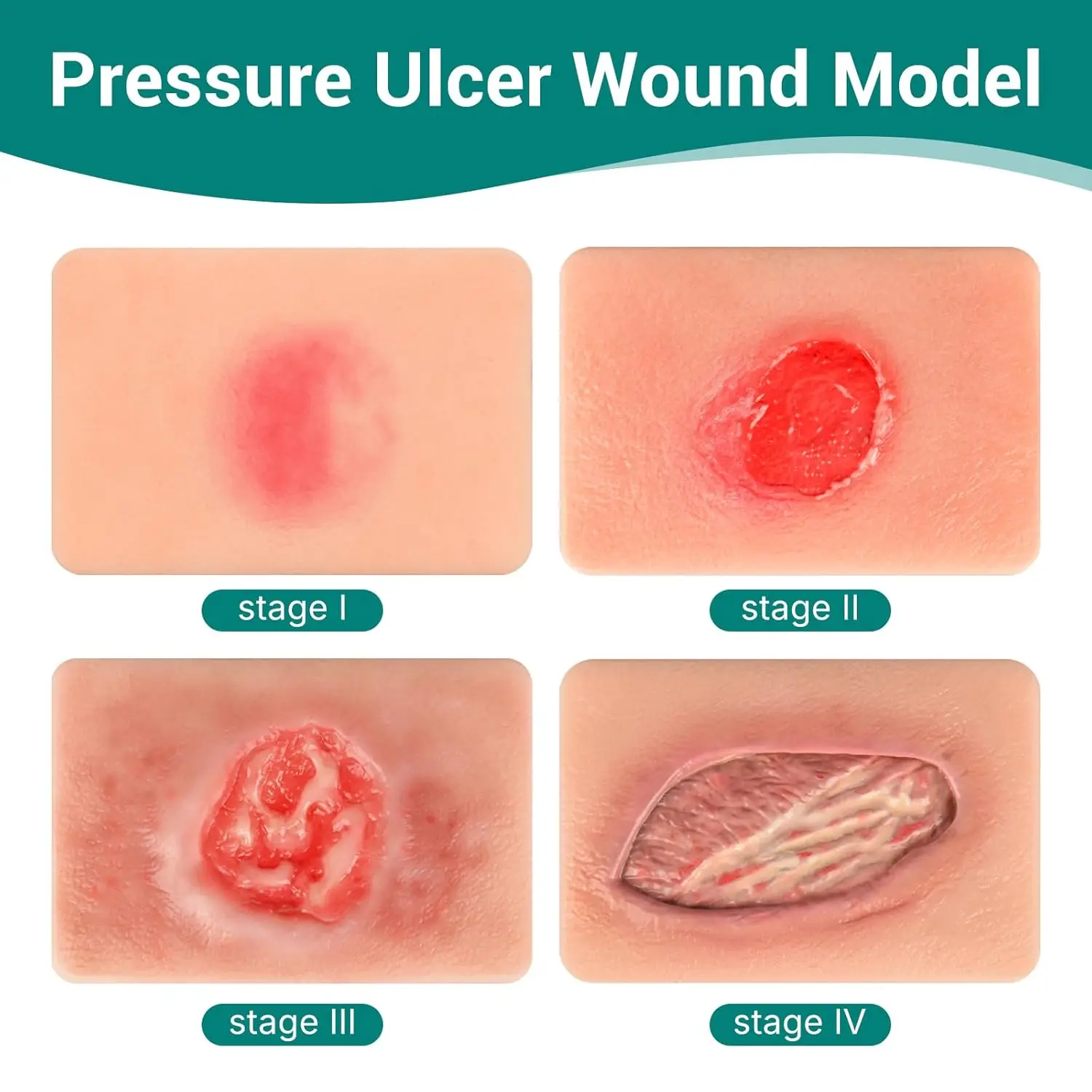 Silicone Bedsore Wound Model Pressure Ulcer Wound Care Packing Trainer Demonstration Tool Pocket Size for Nursing Medical Educat