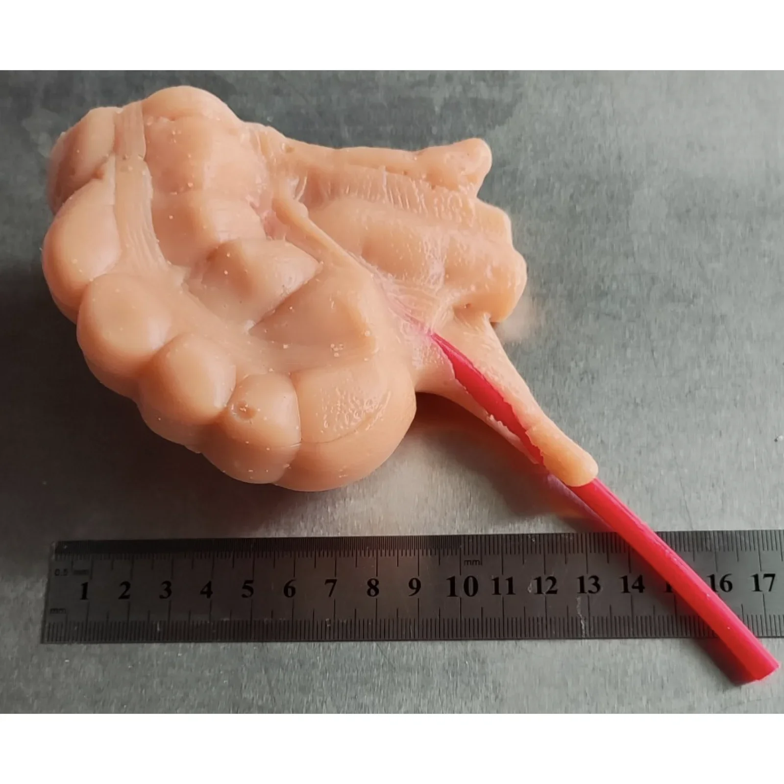 3D appendectomy model with 2mm or 5mm simulated vascular laparoscopic surgery training emulator