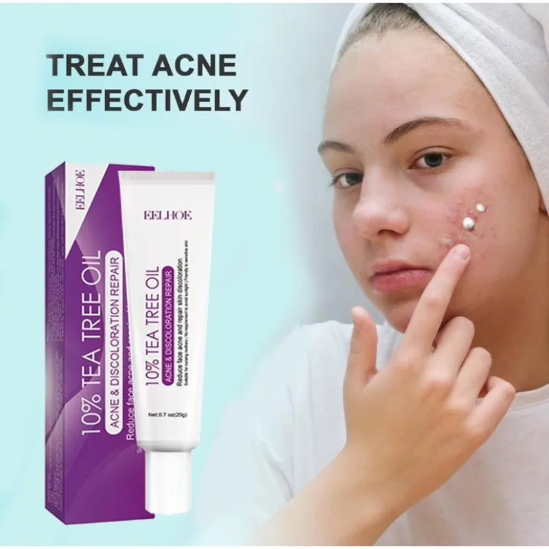 

Acne Cream For Face Pimples Remover Treatment Shrink Pores Oil Control Lighten Acne Marks Whitening Smoothing Facial Skin Care