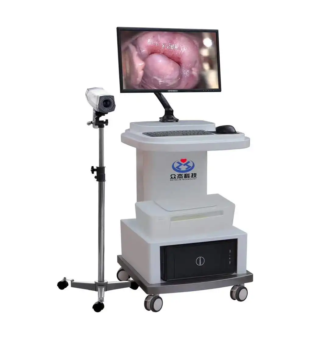 Electronic Colposcope, Digital Colposcope, Visual Colposcope Gynecological Vaginal Examination