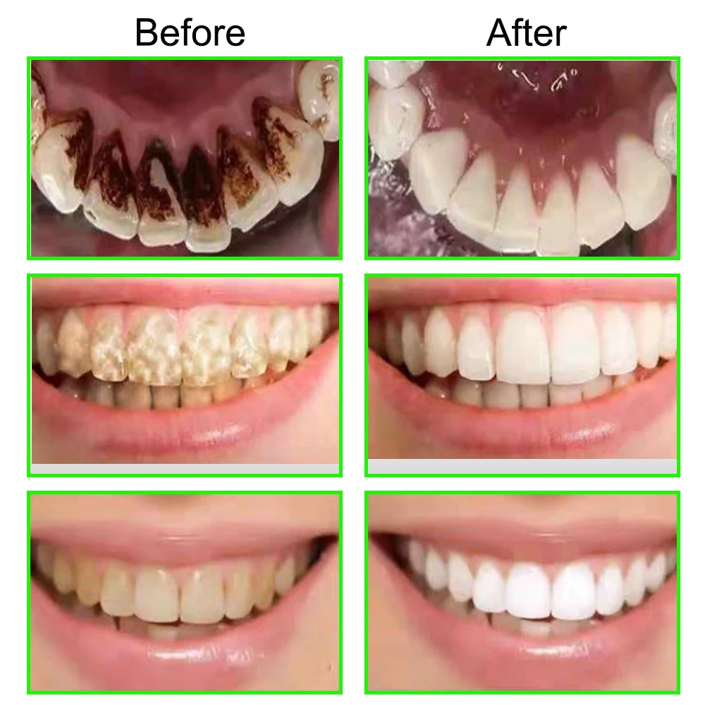 Dentes branqueamento essência em pó limpo higiene oral branqueamento dentes remover manchas de placa respiração fresca higiene oral dental