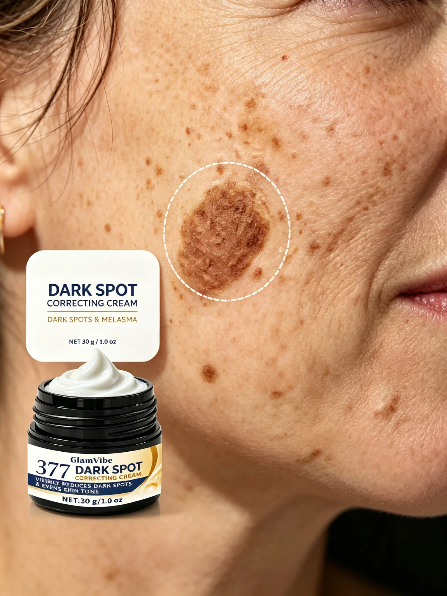 Advanced Dark Spot Remover for Face - Kojic Acid & Collagen Brightening Cream, Hydrating Hyperpigmentation Treatment