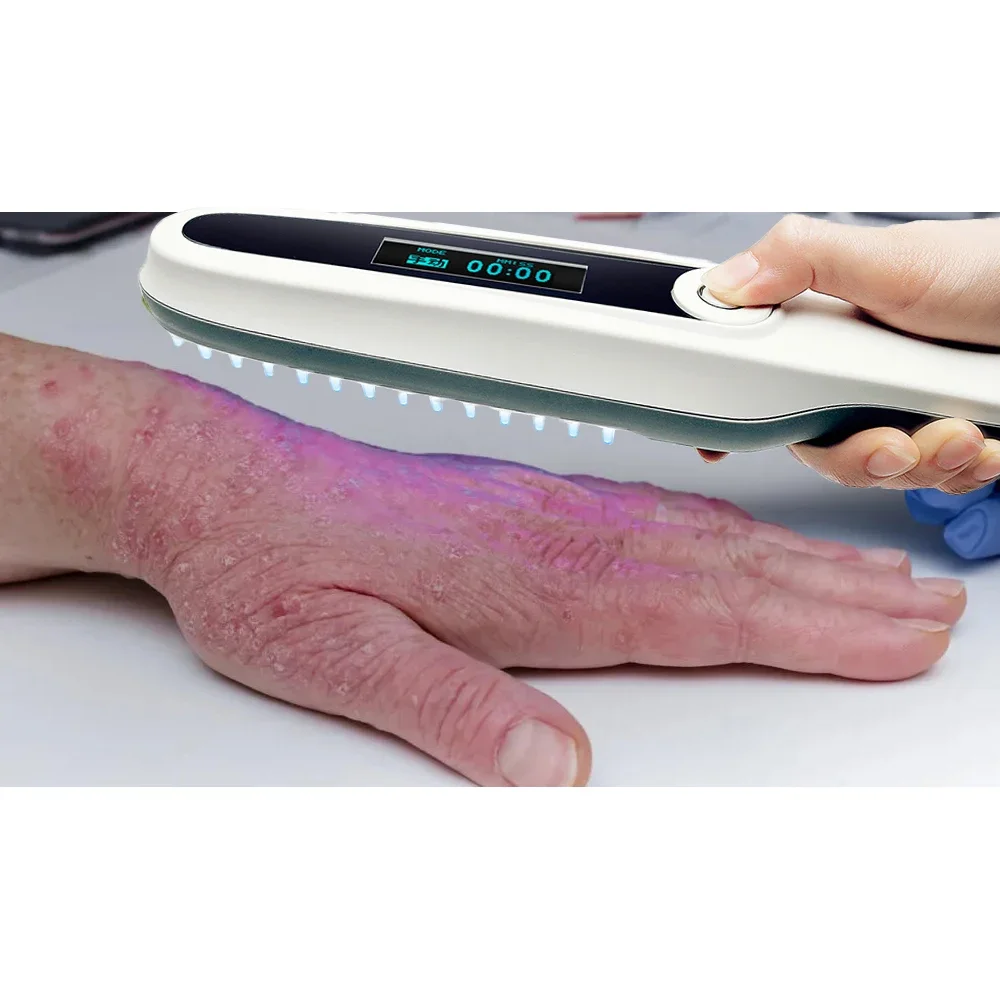 

narrowband phototherapy lamp portable handheld medical light source 48cm2 311nm led uvb lamps for vitiligo psoriasis